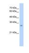 Enoyl-CoA Hydratase 1 antibody, NBP1-54738, Novus Biologicals, Western Blot image 