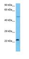 ERCC Excision Repair 2, TFIIH Core Complex Helicase Subunit antibody, orb333108, Biorbyt, Western Blot image 