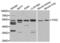 Transcobalamin 2 antibody, LS-C335601, Lifespan Biosciences, Western Blot image 
