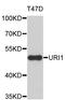 URI1 Prefoldin Like Chaperone antibody, STJ26589, St John