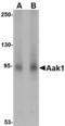 AP2 Associated Kinase 1 antibody, LS-B3843, Lifespan Biosciences, Western Blot image 