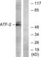 Activating Transcription Factor 2 antibody, LS-C118053, Lifespan Biosciences, Western Blot image 