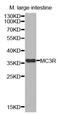 Melanocortin 3 Receptor antibody, MBS128035, MyBioSource, Western Blot image 