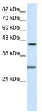 Hes Family BHLH Transcription Factor 6 antibody, TA331853, Origene, Western Blot image 