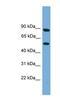 Raftlin Family Member 2 antibody, NBP1-57042, Novus Biologicals, Western Blot image 