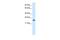 High Mobility Group Box 3 antibody, PA5-68709, Invitrogen Antibodies, Western Blot image 