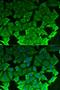 Eukaryotic Elongation Factor 2 Kinase antibody, LS-C334041, Lifespan Biosciences, Immunofluorescence image 