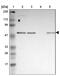 GA Binding Protein Transcription Factor Subunit Alpha antibody, NBP1-84942, Novus Biologicals, Western Blot image 