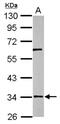RNA Pseudouridine Synthase D3 antibody, NBP2-20229, Novus Biologicals, Western Blot image 