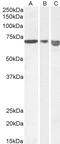 Acid Sensing Ion Channel Subunit 1 antibody, 43-645, ProSci, Enzyme Linked Immunosorbent Assay image 