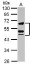 Zinc Finger FYVE-Type Containing 19 antibody, NBP2-20952, Novus Biologicals, Western Blot image 