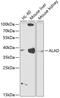 Delta-aminolevulinic acid dehydratase antibody, 14-396, ProSci, Western Blot image 