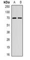 Essential Meiotic Structure-Specific Endonuclease 1 antibody, abx142089, Abbexa, Western Blot image 