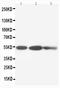 Keratin 8 antibody, PA1240, Boster Biological Technology, Western Blot image 