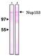 Nucleoporin 153 antibody, GTX00714, GeneTex, Western Blot image 