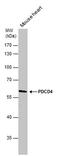 Programmed Cell Death 4 antibody, PA5-28150, Invitrogen Antibodies, Western Blot image 