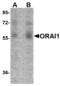 Calcium release-activated calcium channel protein 1 antibody, M00909, Boster Biological Technology, Western Blot image 