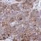 Aspartate Beta-Hydroxylase antibody, HPA059303, Atlas Antibodies, Immunohistochemistry frozen image 