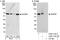 NOP58 Ribonucleoprotein antibody, A302-719A, Bethyl Labs, Western Blot image 