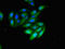CD209 Molecule antibody, LS-C677434, Lifespan Biosciences, Immunofluorescence image 