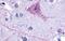 Tachykinin Receptor 3 antibody, GTX70851, GeneTex, Immunohistochemistry paraffin image 