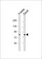 Histone H3 Associated Protein Kinase antibody, A31862-1, Boster Biological Technology, Western Blot image 