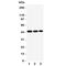 Indian Hedgehog Signaling Molecule antibody, R31349, NSJ Bioreagents, Western Blot image 