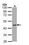 Protein C, Inactivator Of Coagulation Factors Va And VIIIa antibody, PA5-22030, Invitrogen Antibodies, Western Blot image 