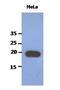 Poly(A) Binding Protein Interacting Protein 2 antibody, LS-C175819, Lifespan Biosciences, Western Blot image 