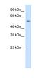 Thyroid Hormone Receptor Beta antibody, orb329901, Biorbyt, Western Blot image 