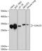 Galectin 3 antibody, 13-756, ProSci, Western Blot image 