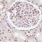 CCCTC-Binding Factor antibody, NBP2-52909, Novus Biologicals, Immunohistochemistry frozen image 