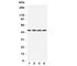 Hyaluronidase 1 antibody, R31303, NSJ Bioreagents, Western Blot image 