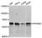 6-phosphofructo-2-kinase/fructose-2,6-biphosphatase 3 antibody, A5262, ABclonal Technology, Western Blot image 