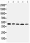 Serpin Family A Member 6 antibody, LS-C313330, Lifespan Biosciences, Western Blot image 
