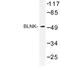 SLP-65 antibody, LS-C192044, Lifespan Biosciences, Western Blot image 