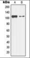 Mitogen-Activated Protein Kinase Kinase Kinase 13 antibody, orb376111, Biorbyt, Western Blot image 