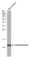 Phospholamban antibody, PA5-78410, Invitrogen Antibodies, Western Blot image 