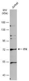 IL2 Inducible T Cell Kinase antibody, NBP1-31732, Novus Biologicals, Western Blot image 