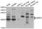 Cysteine And Glycine Rich Protein 2 antibody, LS-C349234, Lifespan Biosciences, Western Blot image 