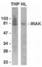 Interleukin 1 Receptor Associated Kinase 1 antibody, PA5-19855, Invitrogen Antibodies, Western Blot image 