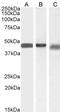 Arrestin Beta 2 antibody, GTX47600, GeneTex, Western Blot image 