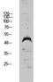 Dual Specificity Phosphatase 4 antibody, STJ99639, St John