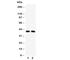 Interferon Regulatory Factor 2 antibody, R30916, NSJ Bioreagents, Western Blot image 