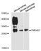 Collectrin, Amino Acid Transport Regulator antibody, LS-C747798, Lifespan Biosciences, Western Blot image 
