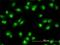 Nuclear Receptor Subfamily 1 Group D Member 2 antibody, H00009975-M01, Novus Biologicals, Immunocytochemistry image 