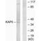 Protein Kinase CAMP-Dependent Type I Regulatory Subunit Alpha antibody, PA5-49786, Invitrogen Antibodies, Western Blot image 