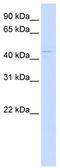Zinc Finger DHHC-Type Containing 16 antibody, TA339610, Origene, Western Blot image 