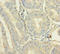 Chromosome 12 Open Reading Frame 49 antibody, LS-C372067, Lifespan Biosciences, Immunohistochemistry paraffin image 