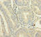 C12orf49 antibody, LS-C372067, Lifespan Biosciences, Immunohistochemistry paraffin image 